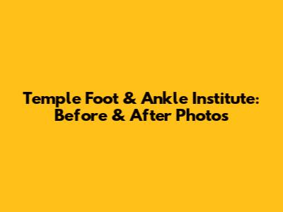 Temple Foot & Ankle Institute: Before & After Photos